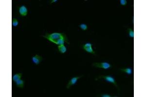IF analysis of PAP/ACP3 using anti-PAP/ACP3 antibody (ABIN7600122). (ACPP 抗体  (AA 150-386))