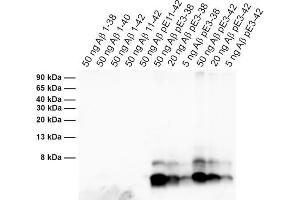 Detection of different synthetic Abeta species (dilution 1 : 1000). (Abeta-pE3 抗体)