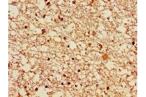 Immunohistochemistry of paraffin-embedded human brain tissue using  at dilution of 1:100 (LRRK2 抗体  (AA 2029-2275))