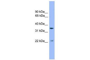 ZDHHC21 antibody used at 1 ug/ml to detect target protein. (ZDHHC21 抗体  (Middle Region))