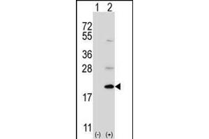 Western blot analysis of Ufc1 (arrow) using rabbit polyclonal Ufc1 Antibody (C-term) (ABIN650703 and ABIN2839221). (UFC1 抗体  (C-Term))