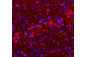 Immunofluorescent analysis of paraformaldehyde-fixed rat brain using VMAT2 (ABIN7075655) at dilution of 1: 1600 (SLC18A2 抗体)