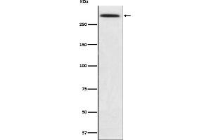Western blot analysis of SPTA1 expression in K562 cell lysate.