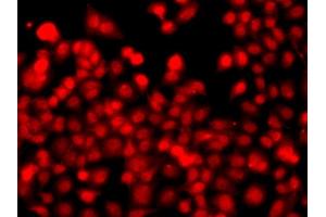 Immunofluorescence analysis of  cells using TH antibody (ABIN6128823, ABIN6149105, ABIN6149106 and ABIN6223361). (THAP1 抗体  (AA 1-213))