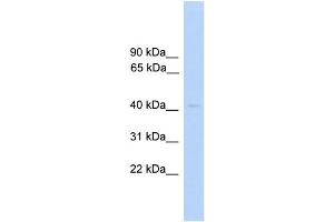 WB Suggested Anti-PRKAR1A Antibody Titration: 0. (PRKAR1A 抗体  (C-Term))