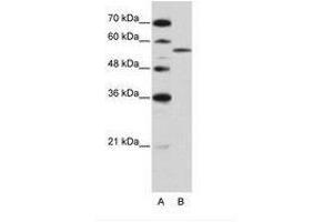 Image no. 2 for anti-Zinc Finger (CCCH Type), RNA-Binding Motif and serine/arginine Rich 2 (ZRSR2) (AA 369-418) antibody (ABIN202635)