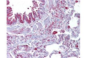 Immunohistochemistry (IHC) image for anti-gamma-aminobutyric Acid (GABA) A Receptor, beta 3 (GABRB3) (AA 180-229) antibody (ABIN6748502)