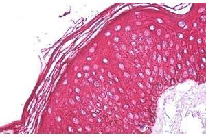 Anti-Cytokeratin 1 / Keratin 1 antibody IHC staining of human skin. (Cytokeratin 1 抗体  (Internal Region))