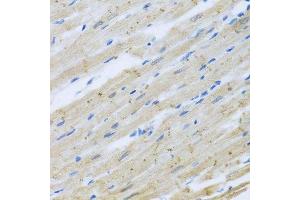 Immunohistochemistry of paraffin-embedded rat heart using CLIP1 antibody. (CLIP1 抗体  (AA 1228-1427))