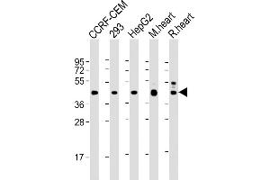 All lanes : Anti-VEGFC at 1:2000 dilution Lane 1: CCRF-CEM whole cell lysate Lane 2: 293 whole cell lysate Lane 3: HepG2 whole cell lysate Lane 4: mouse heart lysate Lane 5: rat heart lysate Lysates/proteins at 20 μg per lane. (VEGFC 抗体)