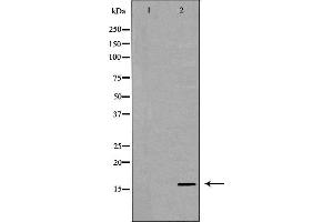 Western blot analysis of extracts of recombinant protein using IL13 antibody.