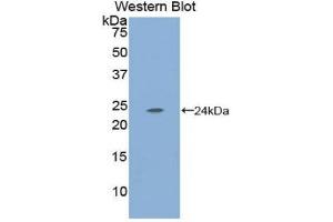 Western Blotting (WB) image for anti-Carbonic Anhydrase I (CA1) (AA 15-223) antibody (ABIN1173857) (CA1 抗体  (AA 15-223))