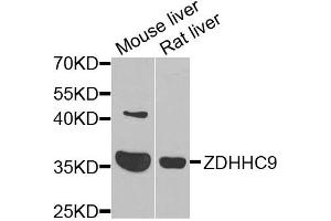 Western blot analysis of extracts of various cells, using ZDHHC9 antibody. (ZDHHC9 抗体)