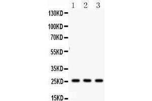 Anti- SFTP A1/2 Picoband antibody, Western blotting All lanes: Anti SFTP  at 0. (SFTPA1/ 2 (AA 206-237), (C-Term) 抗体)