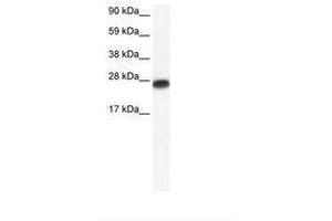 Image no. 1 for anti-Myogenic Factor 6 (MYF6) (AA 66-115) antibody (ABIN6735892) (MYF6 抗体  (AA 66-115))