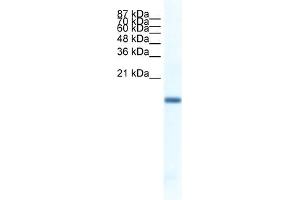 WB Suggested Anti-FERD3L Antibody   Titration: 1. (FERD3L 抗体  (N-Term))