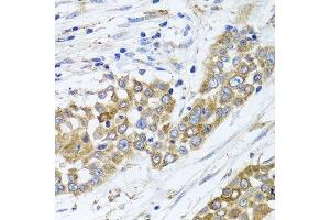 Immunohistochemistry (Paraffin-embedded Sections) (IHC (p)) image for anti-Peroxisomal Biogenesis Factor 14 (PEX14) (AA 118-377) antibody (ABIN6145458)