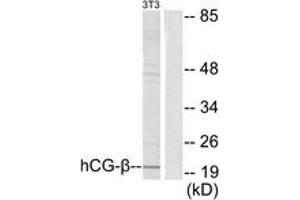 Western blot analysis of extracts from NIH-3T3 cells, using hCG beta Antibody. (HCG beta 抗体  (AA 101-150))