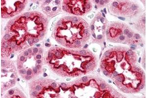 Human Kidney: Formalin-Fixed, Paraffin-Embedded (FFPE) (TAB3 抗体  (N-Term))