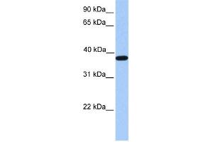 WB Suggested Anti-ACTRT2 Antibody Titration: 0. (ACTRT2 抗体  (C-Term))