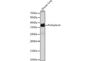 Western blot analysis of extracts of Mouse lung, using Podoplanin Rabbit mAb (ABIN7269430) at 1:1000 dilution. (Podoplanin 抗体)