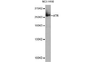 Western blot analysis of extracts of NCI-H460 cells, using ATR Antibody (ABIN5974366) at 1/1000 dilution. (ATR 抗体)