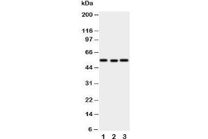 Western blot testing of XIAP antibody and Lane 1:  SMMC-7721;  2: HeLa;  3: A431 cell lysate (XIAP 抗体  (N-Term))