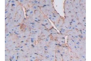 Immunohistochemistry (IHC) image for anti-Albumin (ALB) antibody (ABIN7429667)