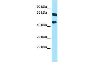 WB Suggested Anti-HABP4 Antibody Titration: 1. (HABP4 抗体  (N-Term))