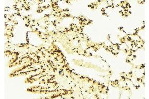 ABIN6273002 at 1/100 staining Mouse lung tissue by IHC-P. (ISCU 抗体  (Internal Region))