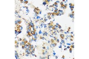 Immunohistochemistry (IHC) image for anti-Apolipoprotein B mRNA Editing Enzyme, Catalytic Polypeptide-Like 3F (APOBEC3F) (AA 1-65) antibody (ABIN3016159)