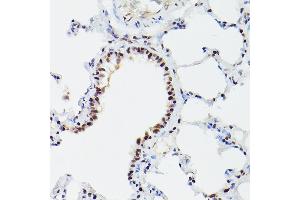 Immunohistochemistry (IHC) image for anti-Cleavage and Polyadenylation Specific Factor 6, 68kDa (CPSF6) antibody (ABIN6138974)