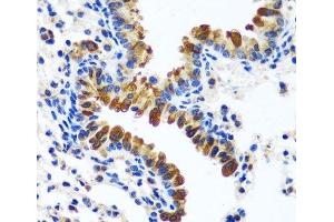 Immunohistochemistry (Paraffin-embedded Sections) (IHC (p)) image for anti-Calcium Modulating Ligand (CAMLG) antibody (ABIN7257333)