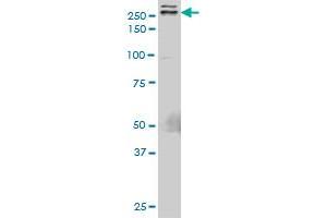 TLN1 monoclonal antibody (M05), clone 5C1. (TLN1 抗体  (AA 1052-1149))