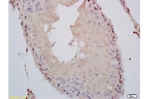 Formalin-fixed and paraffin embedded rat testis labeled with Rabbit Anti phospho-Androgen Receptor(Ser578) Polyclonal Antibody, Unconjugated (ABIN730123) at 1:200 followed by conjugation to the secondary antibody and DAB staining (Androgen Receptor 抗体  (pSer578))