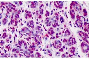 Human Breast: Formalin-Fixed, Paraffin-Embedded (FFPE) (Bcl-2 抗体  (FITC))
