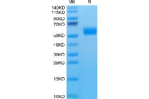 SDS-PAGE (SDS) image for Killer Cell Lectin-Like Receptor Subfamily K, Member 1 (KLRK1) (AA 90-232) protein (Fc Tag) (ABIN7275346)