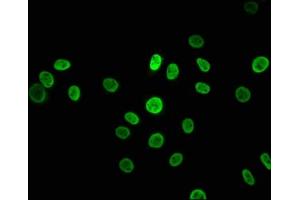 Immunofluorescence staining of A549 cells with ABIN7127548 at 1:43. (Recombinant HNRNPK 抗体)