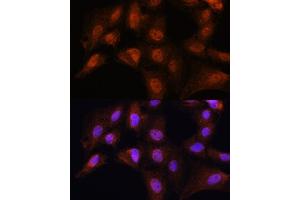 Immunofluorescence analysis of C6 cells using BCL3 Rabbit pAb (ABIN6134239, ABIN6137509, ABIN6137510 and ABIN7101379) at dilution of 1:100. (BCL3 抗体  (AA 300-400))
