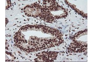 Image no. 1 for anti-Exosome Component 7 (EXOSC7) antibody (ABIN1498140) (EXOSC7 抗体)