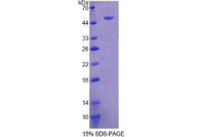 SDS-PAGE of Protein Standard from the Kit (Highly purified E. (Fibrinogen beta Chain ELISA 试剂盒)