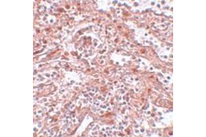 Immunohistochemical staining of human spleen tissue with LIN28 polyclonal antibody  at 5 ug/mL dilution. (LIN28A 抗体  (C-Term))