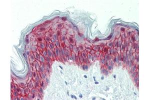 IHC-P Image Immunohistochemical analysis of paraffin-embedded human skin, using Galanin Receptor 2, antibody(10 μg/ml). (GALR2 抗体  (C-Term))