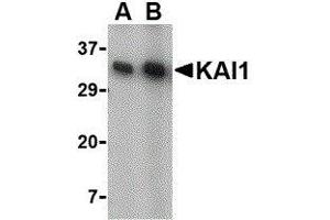 Western Blotting (WB) image for anti-CD82 (CD82) (C-Term) antibody (ABIN2472638) (CD82 抗体  (C-Term))
