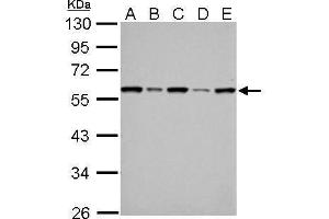 WB Image FKBP4 antibody detects FKBP4 protein by Western blot analysis. (FKBP4 抗体  (Center))