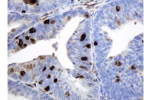 Image no. 8 for anti-Thymidine Phosphorylase (TYMP) (AA 311-482) antibody (ABIN1491396)
