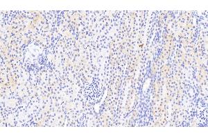Detection of PARP4 in Human Kidney Tissue using Polyclonal Antibody to Poly ADP Ribose Polymerase 4 (PARP4) (PARP4 抗体  (AA 338-609))