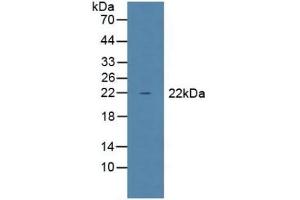 Detection of GPX1 in Mouse Liver Tissue using Polyclonal Antibody to Glutathione Peroxidase 1 (GPX1) (Glutathione Peroxidase 1 抗体  (AA 50-203))