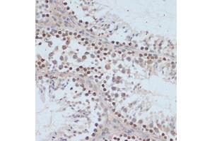 Immunohistochemistry of paraffin-embedded mouse testis using Phospho-BRC-S1423 antibody (ABIN3019880, ABIN3019881, ABIN3019882 and ABIN6225497) at dilution of 1:100 (40x lens). (BRCA1 抗体  (pSer1423))