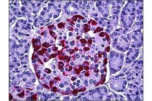 Human Pancreas, Islets of Langerhans: Formalin-Fixed, Paraffin-Embedded (FFPE) (HGS 抗体  (Internal Region))